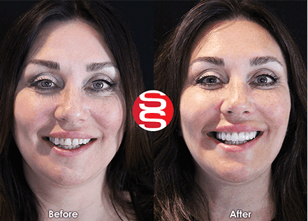 Ashley Before - After